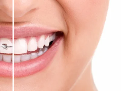 image representing Ortho + Preventive Dentistry