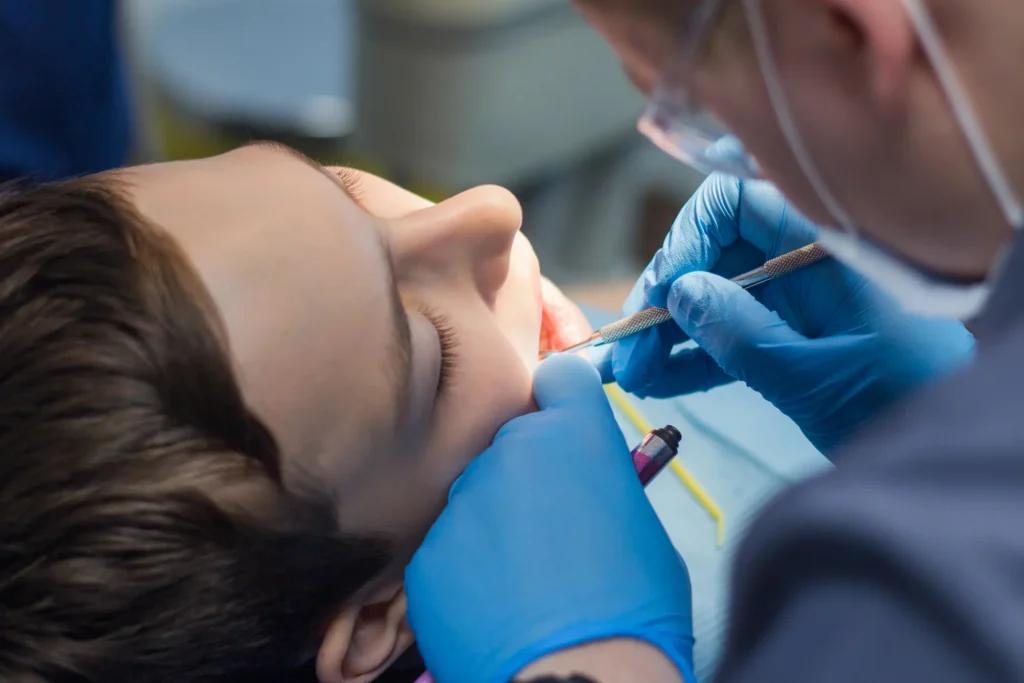dental sealant procedure in Bakersfield, CA