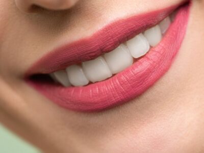 person with a healthy confident smile after braces in Bakersfield