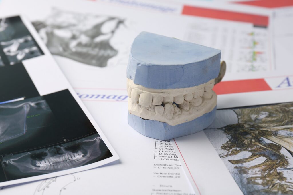 dental plans bakersfield
