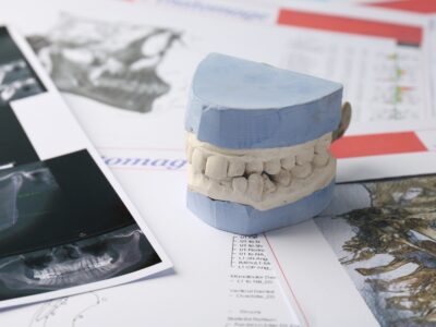 dental plans bakersfield