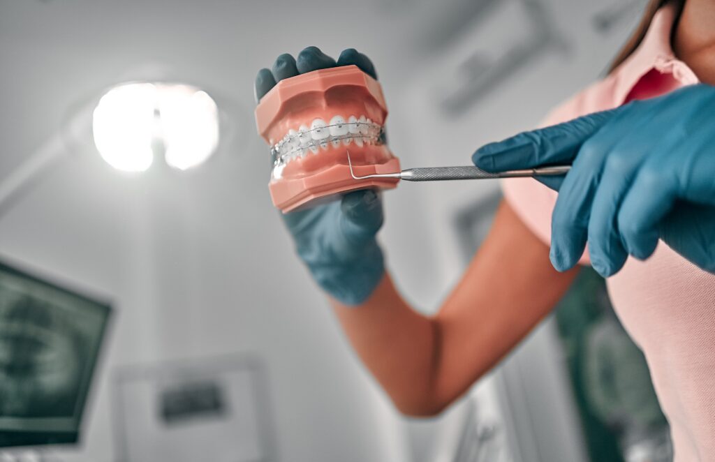 orthodontist holding a teeth with braces sample