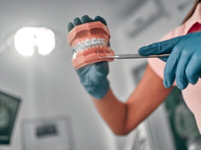 orthodontist holding a teeth with braces sample
