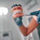 orthodontist holding a teeth with braces sample
